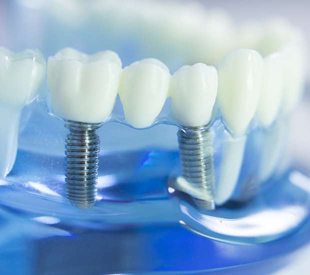 Stamford Dental Implants