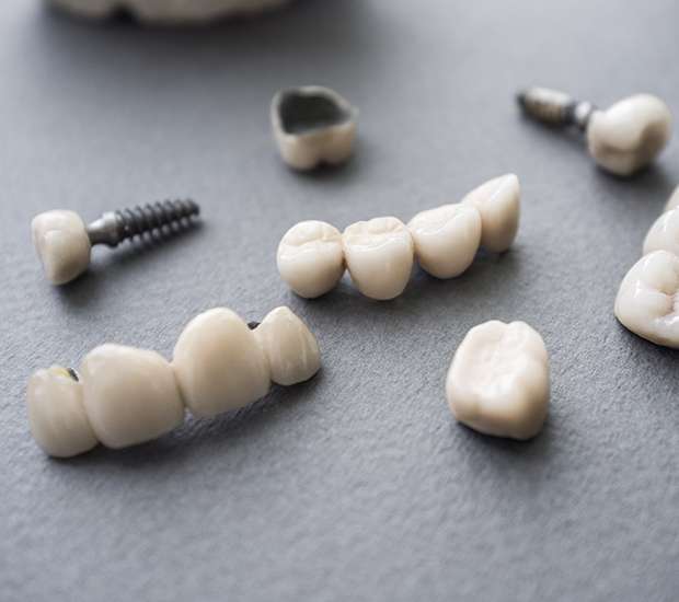 Stamford The Difference Between Dental Implants and Mini Dental Implants